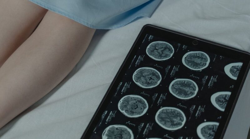 Critical AI Patent: ARA's Enduring Impact on Intensive Care by 2026