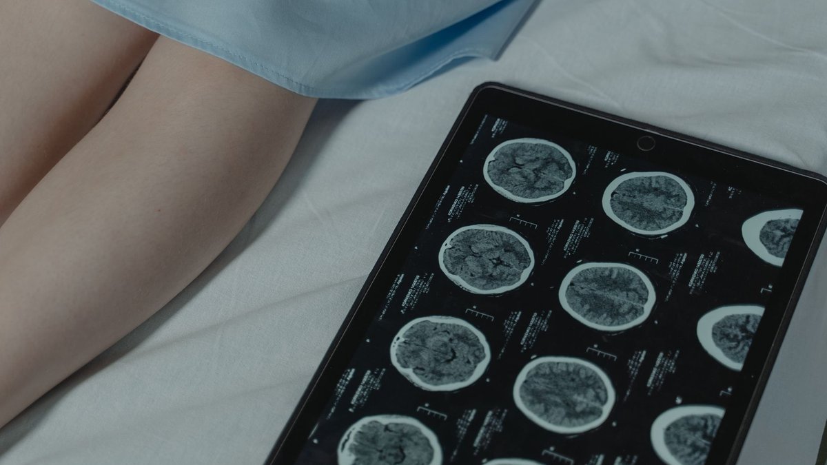 Critical AI Patent: ARA's Enduring Impact on Intensive Care by 2026